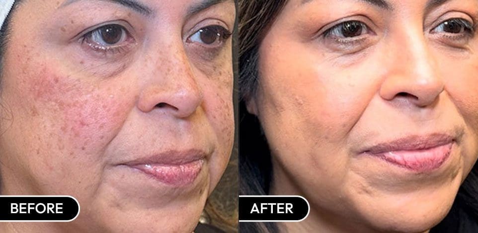 attiva RF in Houston, Texas