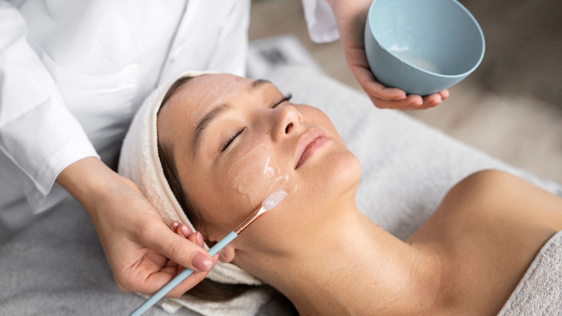 Chemical Peel